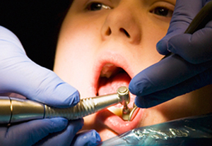 The issue of oral health. Image of a child having teeth cleaned.