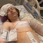 Linden Cameron, a 13-year-old with autism, lies in a hospital bed after being shot multiple times by a police officer