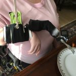 A person with limited arm mobility wears a mechanical cuff on her forearm with a fork that pivots from her plate to her mouth