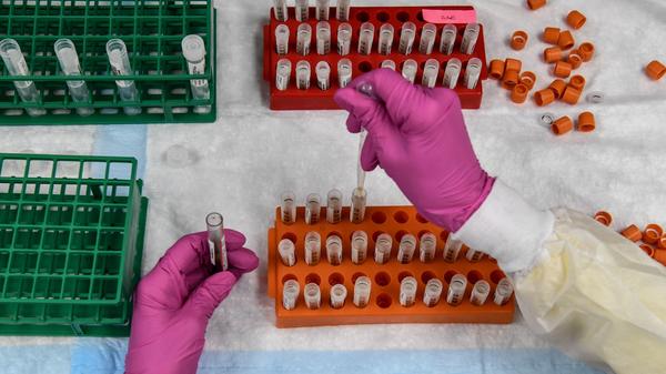 The arms of a researcher, covered in a lab coat and protective gloves, hover over several racks of test tubes. The right hand squeezes an eye dropper to add liquid into a test tube.
