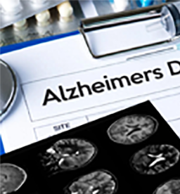 Clipboard with paper with the word Alzheimers and sheet of brain scan images.